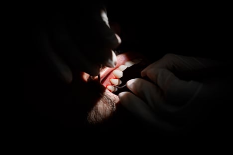 igiene-dentale-2